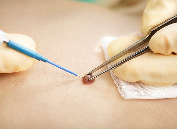 Dermatologia cirurgica